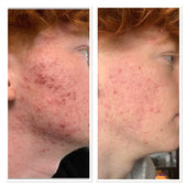 Copy of Before After #DQZ9QTRM