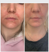 Copy of Before After #DQZ9QTRM