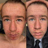 Copy of Before After #DQZ9QTRM