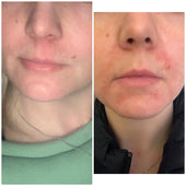 Copy of Before After #DQZ9QTRM