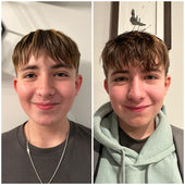 Copy of Before After #DQZ9QTRM