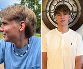 Copy of Before After #DQZ9QTRM