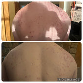 Copy of Before After #DQZ9QTRM