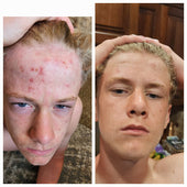 Copy of Before After #DQZ9QTRM