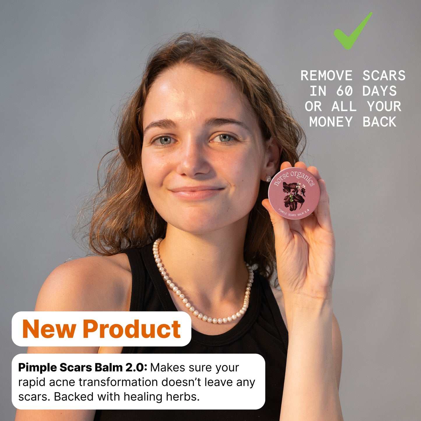 Pimple Scars Balm 2.0