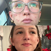 Copy of Before After #DQZ9QTRM