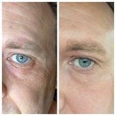 Copy of Before After #DQZ9QTRM