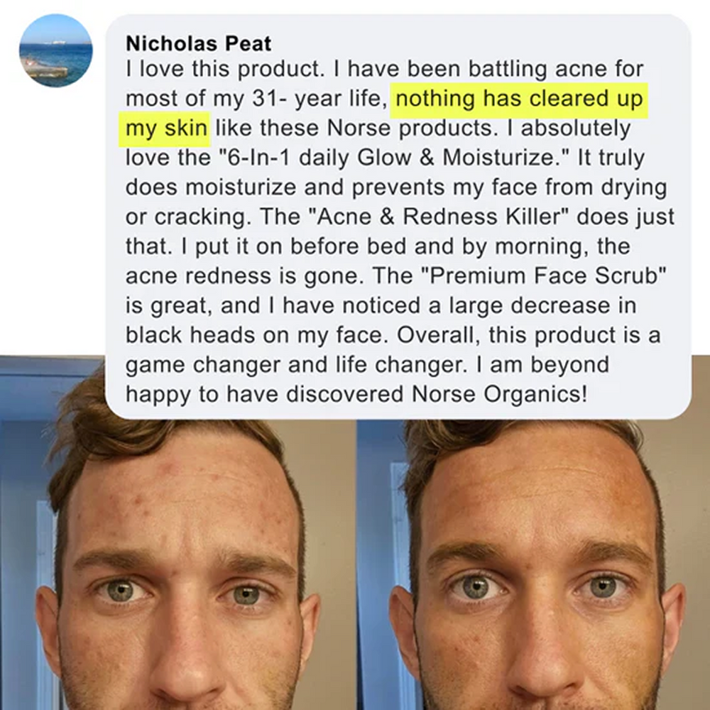 Skin transformation testimonial