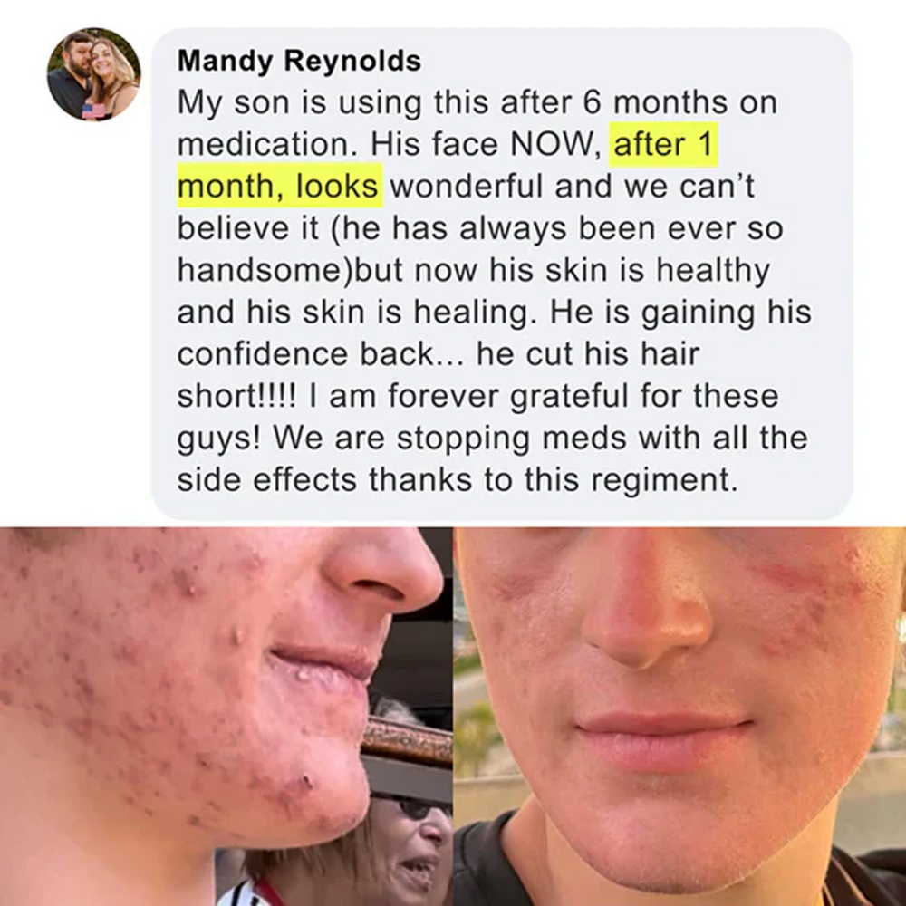 Skin transformation testimonial