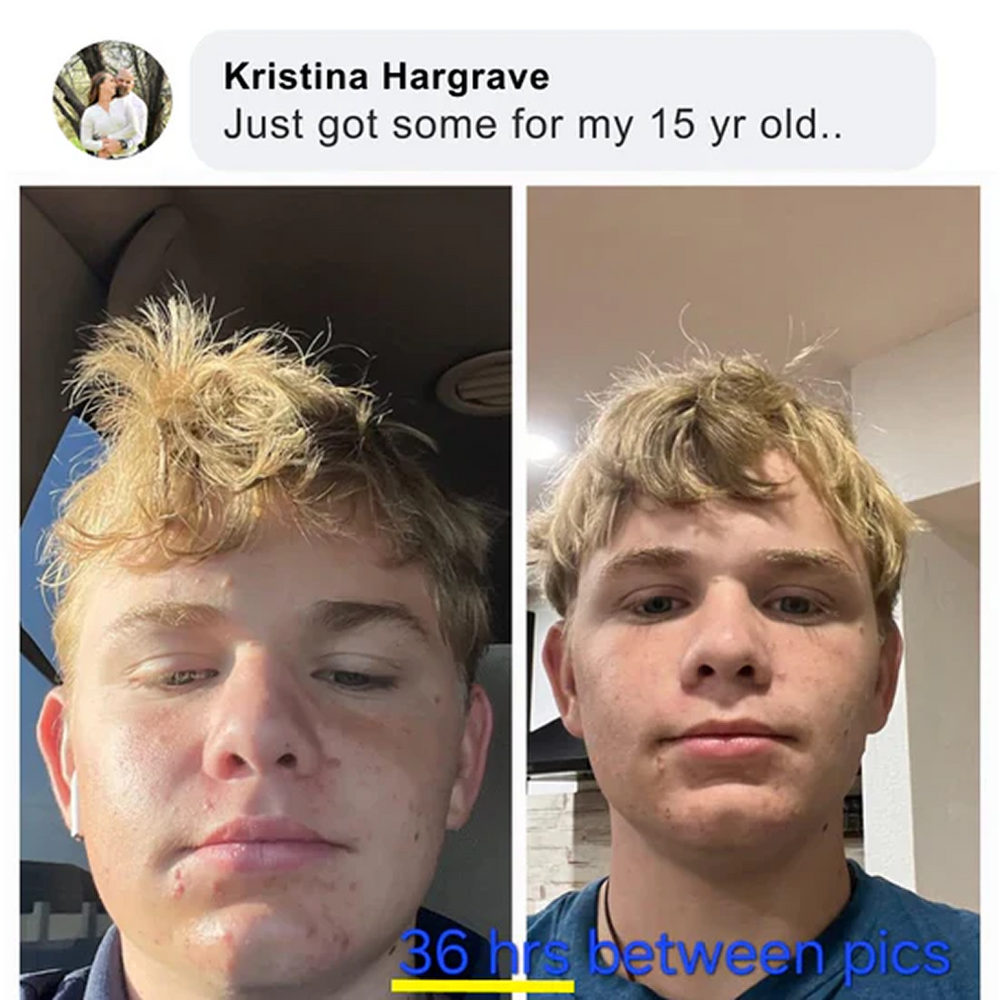 Skin transformation testimonial