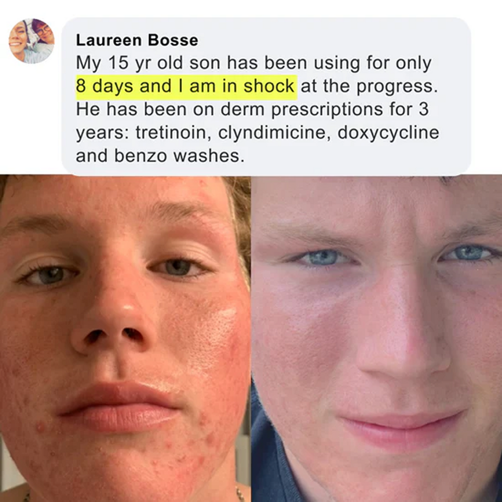 Skin transformation testimonial