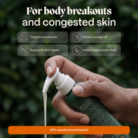 Body Soap for Acne-Prone Skin - Slide 2