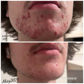 Copy of Before After #DQZ9QTRM