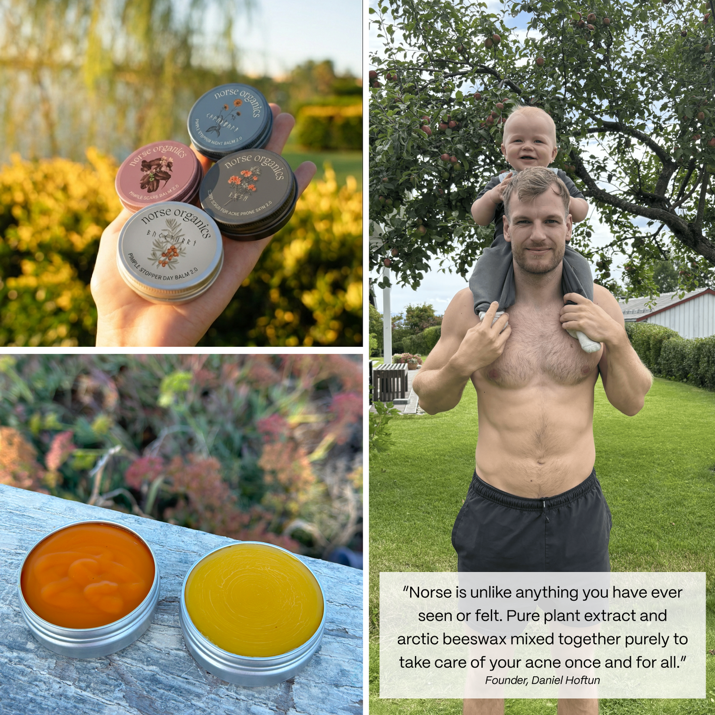 The Complete Acne Killer System 2.0