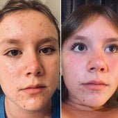 Copy of Before After #DQZ9QTRM