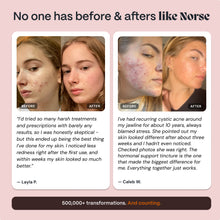 Compleet Darmherstel & Hormoonbalans Systeem voor Vrouwelijke Acne
