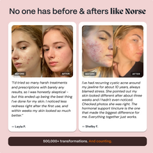 Complete Gut Repair & Hormone Health System for Female Acne-Prone Skin
