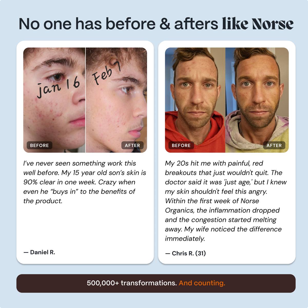 Complete Gut Repair & Hormone Health System for Male Acne-Prone Skin