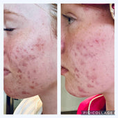 Copy of Before After #DQZ9QTRM