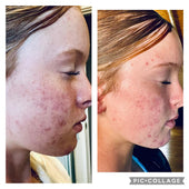 Copy of Before After #DQZ9QTRM