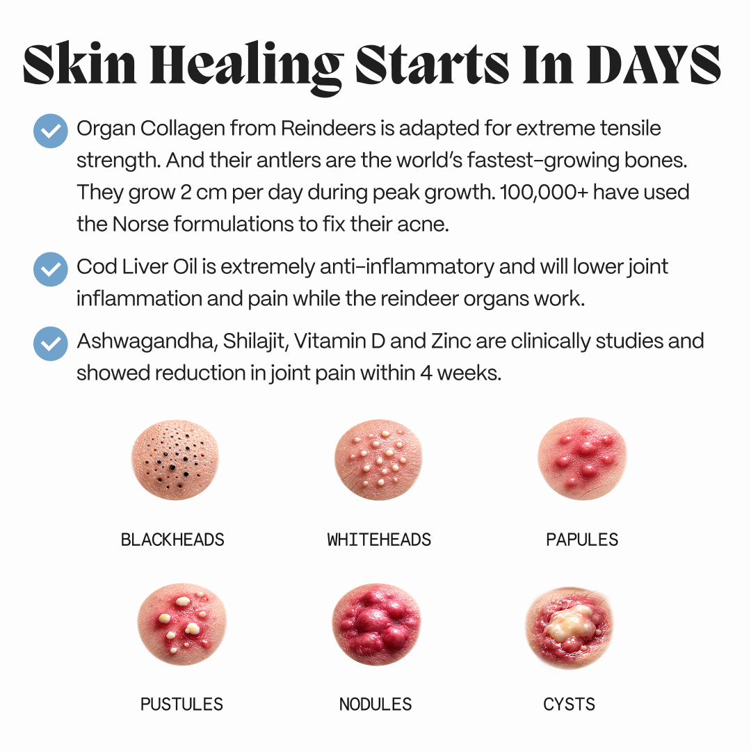 Graphic on how the female gut repair system supports skin, with acne-type illustrations