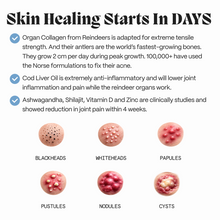 Complete Gut Repair & Hormonal Balance System for Female Acne