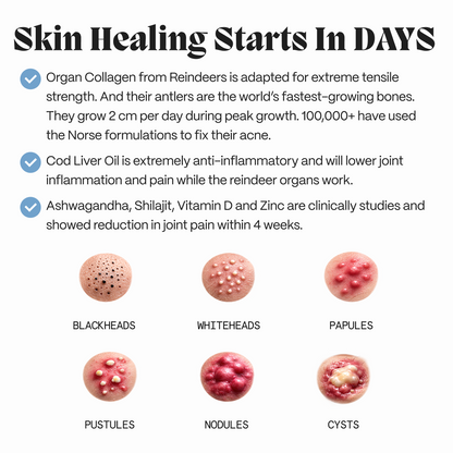 Graphic on how the female gut repair system supports skin, with acne-type illustrations