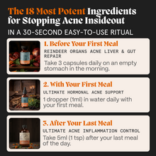 Complete Gut Repair & Hormonal Balance System for Male Acne