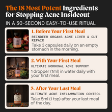 Complete Gut Repair & Hormonal Balance System for Female Acne