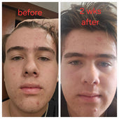 Copy of Before After #DQZ9QTRM