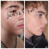 Copy of Before After #DQZ9QTRM