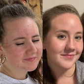 Copy of Before After #DQZ9QTRM