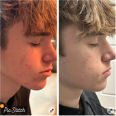 Copy of Before After #DQZ9QTRM