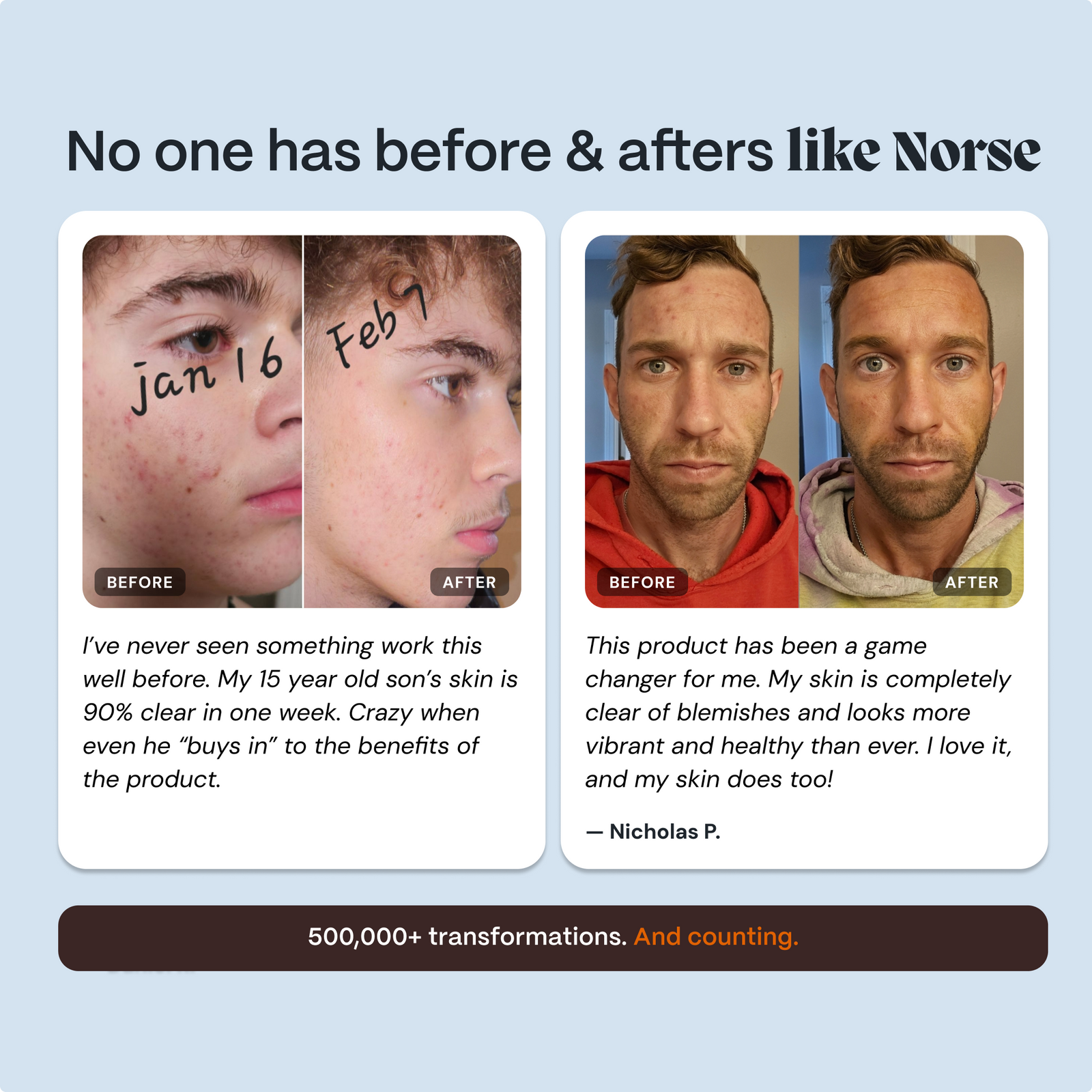 Before and after face photos with customer testimonials about the Norse Organics system