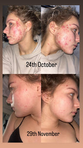 Copy of Before After #DQZ9QTRM