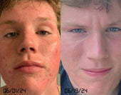 Copy of Before After #DQZ9QTRM