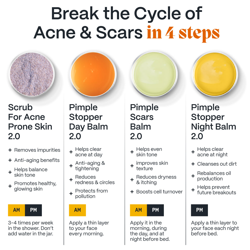 The Complete Acne Killer System 2.0