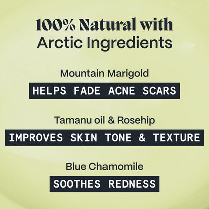 Pimple Scars Balm 2.0