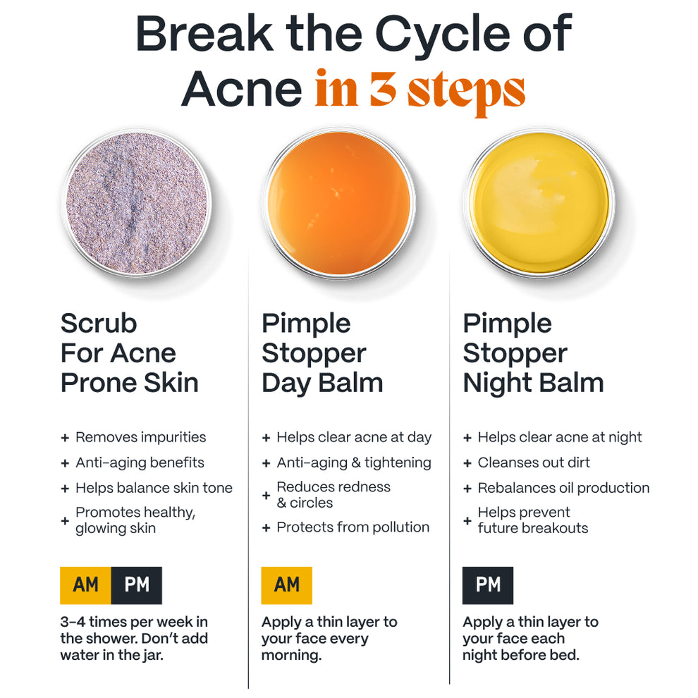 Kill Acne & Redness Ritual | Skincare Routine For Acne – Norse Organics