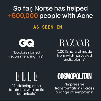 Body Balm for Acne Prone Skin