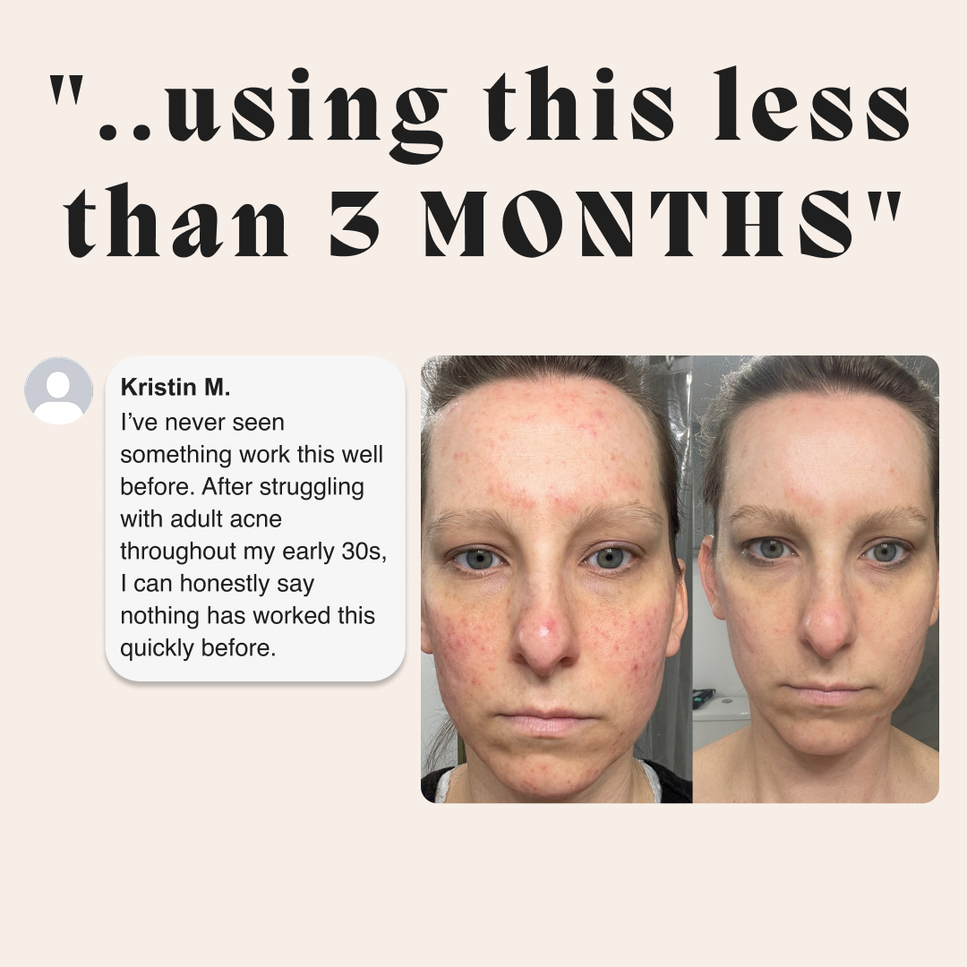 Before and after of a woman's face with a customer testimonial about the female gut repair system
