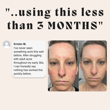 Before and after of a woman's face with a customer testimonial about the female gut repair system