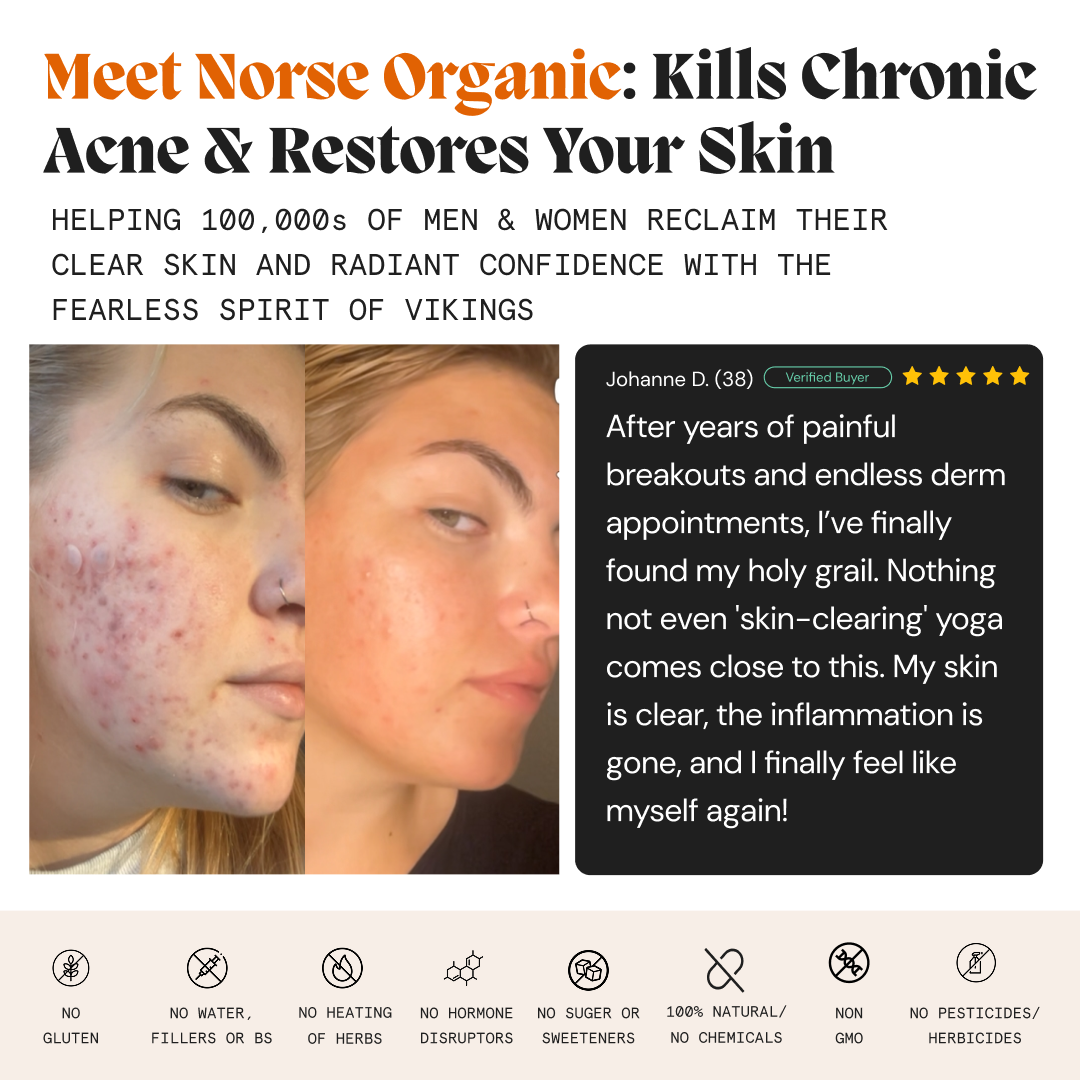 Before and after of a woman's face with a customer testimonial for the female gut repair system