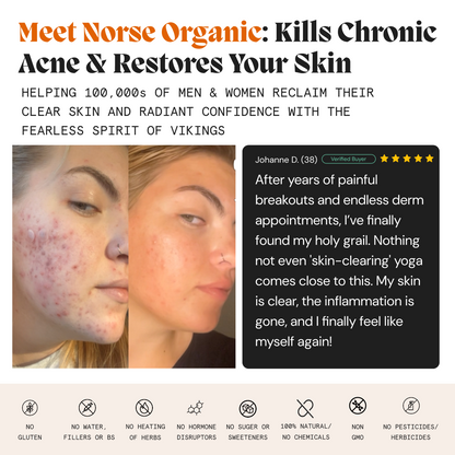 Before and after of a woman's face with a customer testimonial for the female gut repair system
