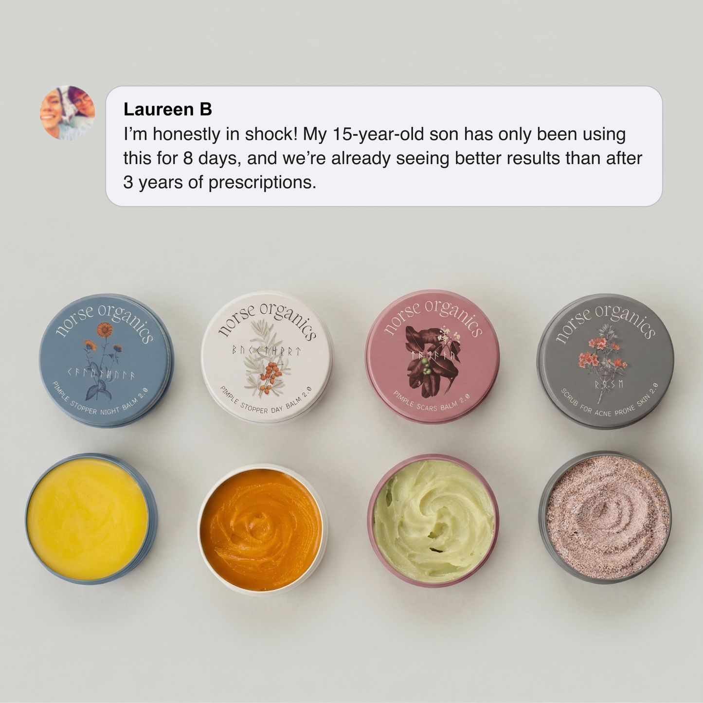 The Complete Acne Killer System 2.0