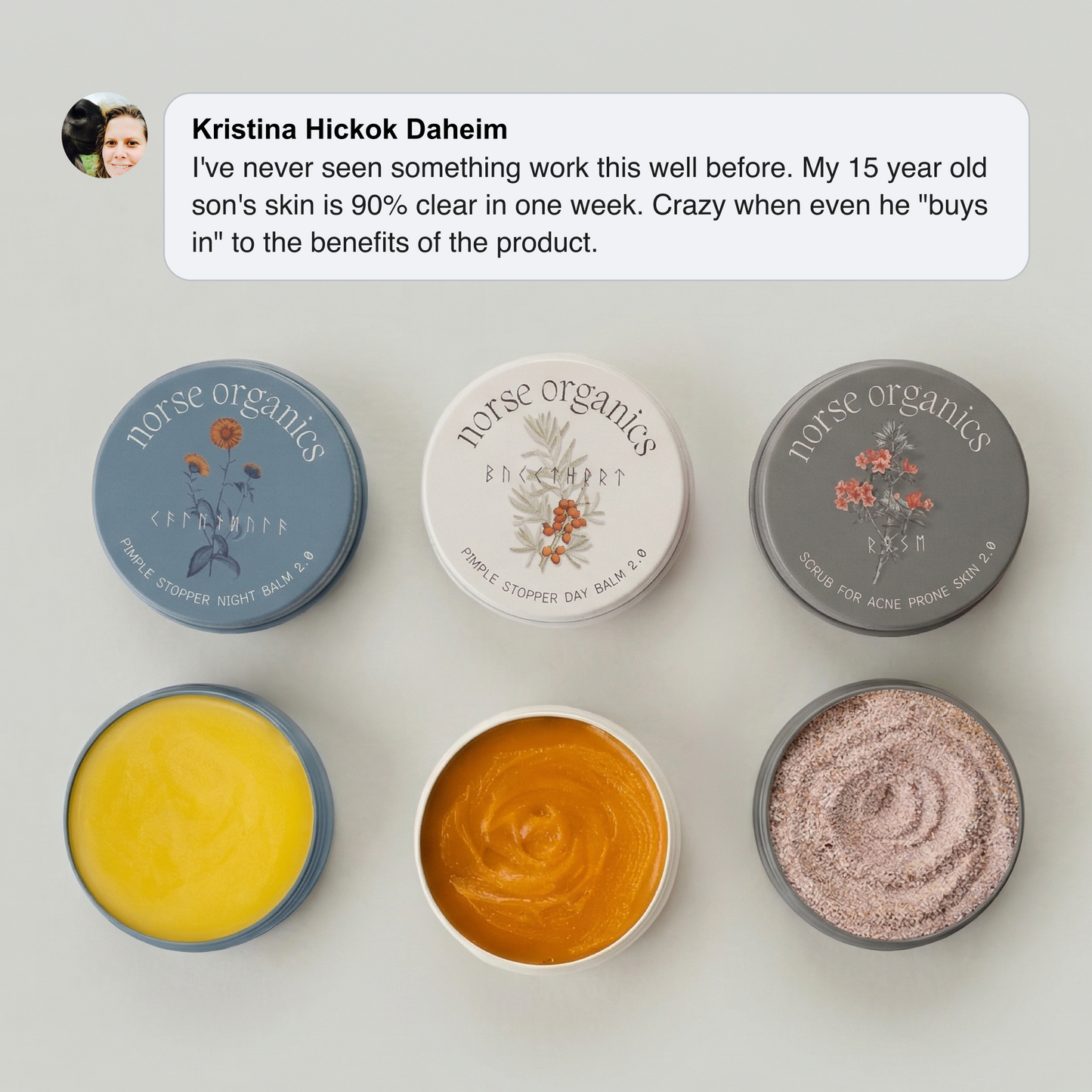 Kill Acne & Redness Ritual