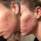 Copy of Before After #DQZ9QTRM