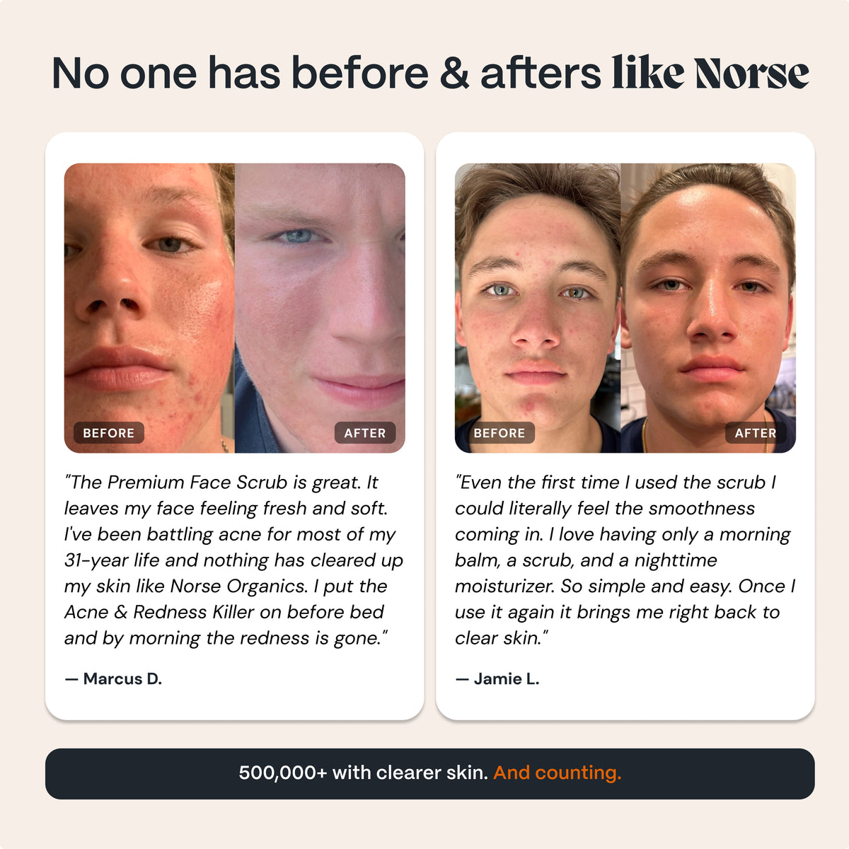 Peeling für zu Akne neigende Haut