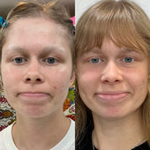 Copy of Before After #DQZ9QTRM