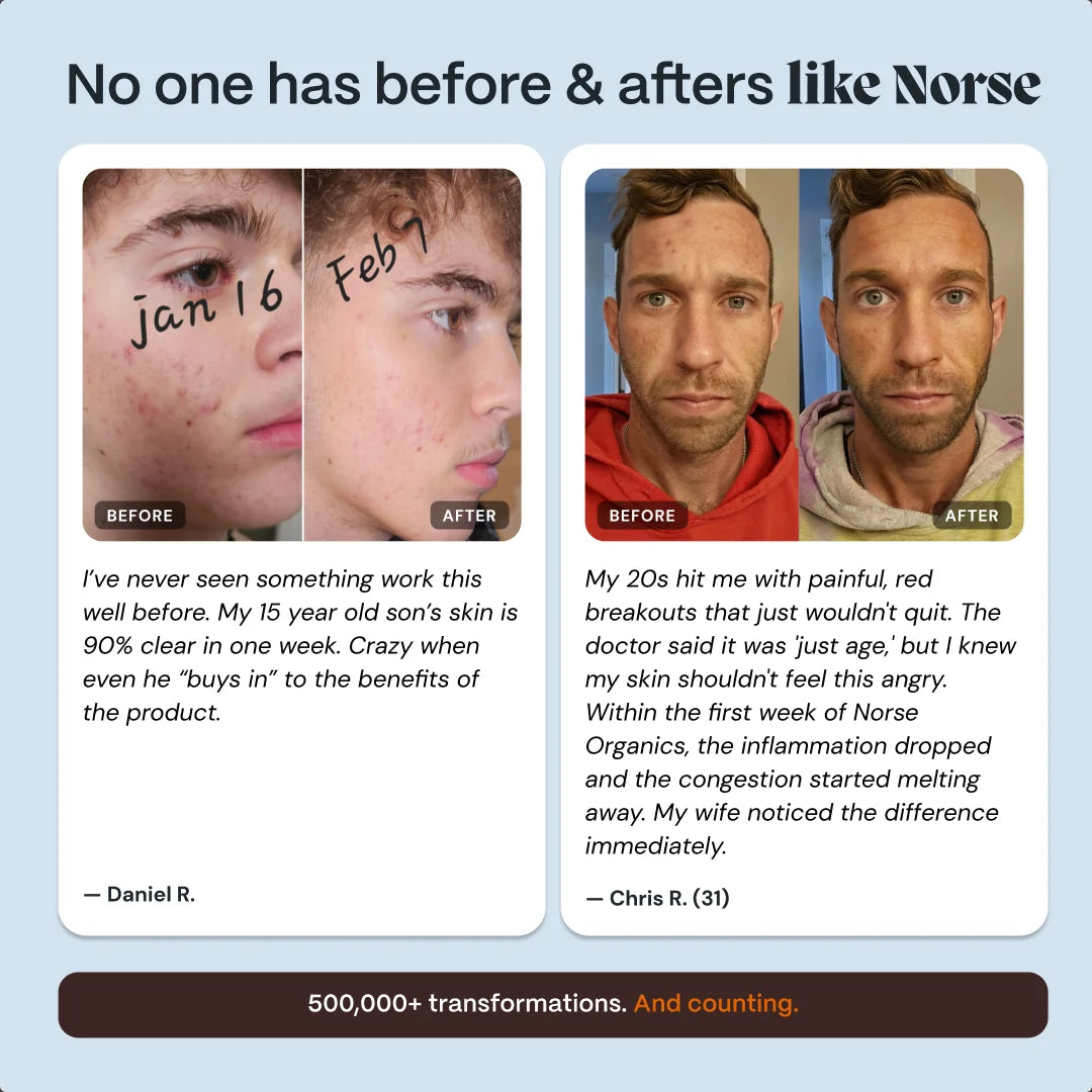 Norse Organics product gallery slide